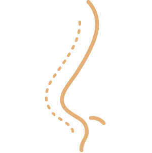 Rinoplasti